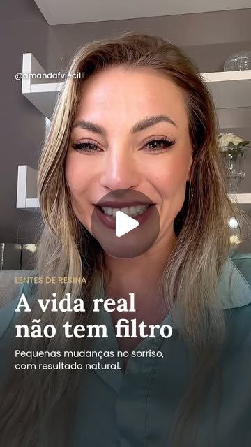 Dra. Amanda Viecilli falando sobre lentes de resina sem desgaste em Canoas